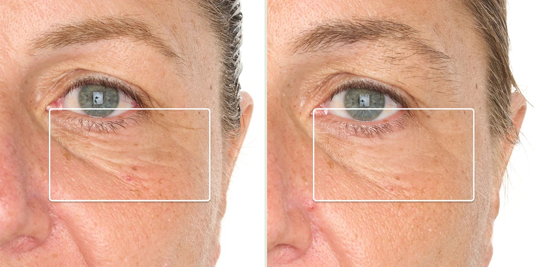 Red LED Light Therapy Before & After: Real Results, Backed by Clinical Science