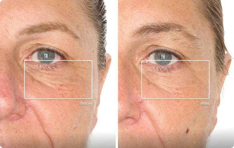 Theragun-Prime-Gen-5-Hero-1-New.webp-2