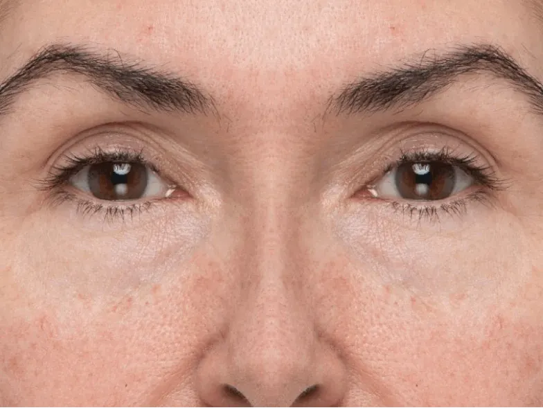 after face photo using product